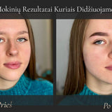 Mokinės antakių korekcijos rezultatas prieš ir po 2
